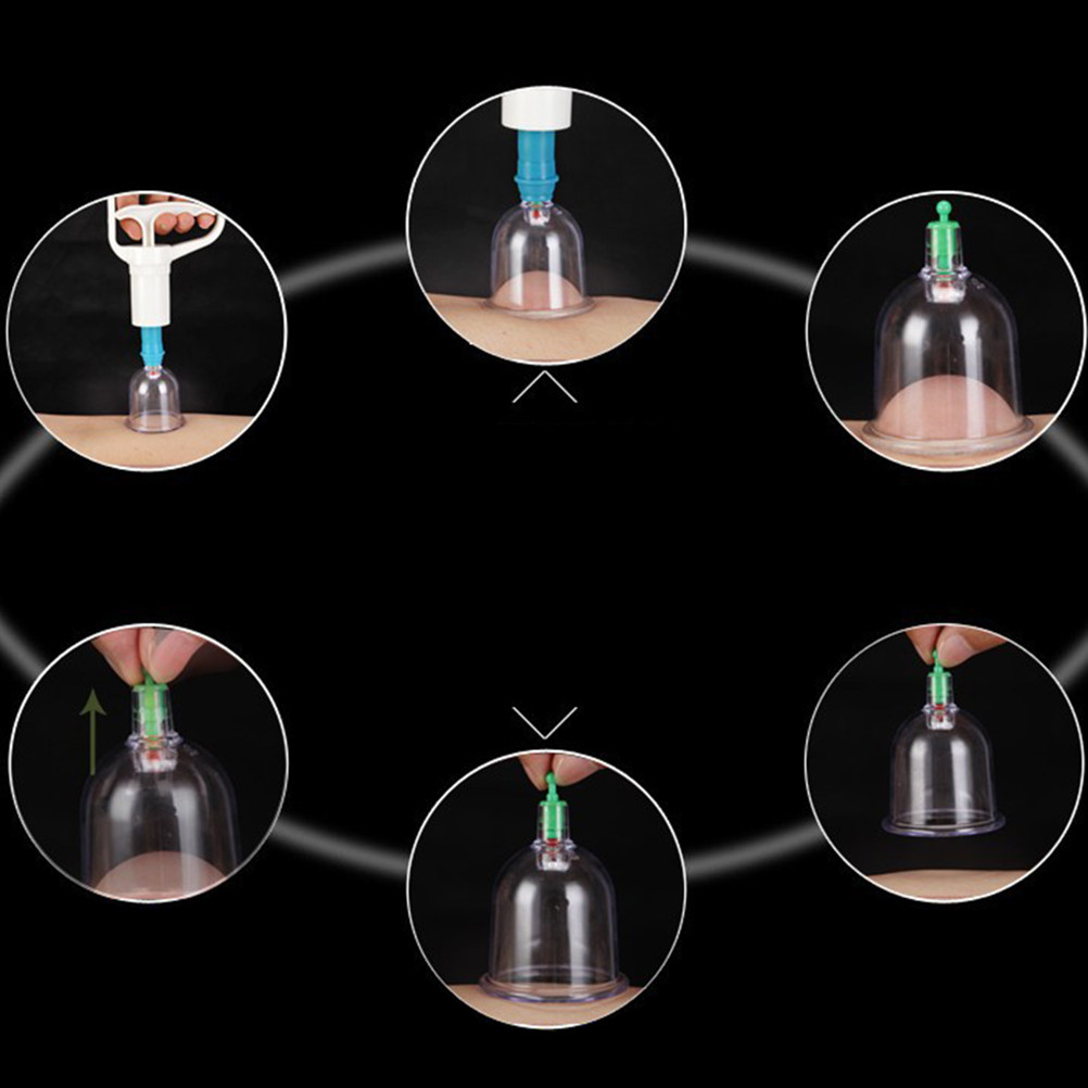 24 Vacuum Cupping Cups Kit Hom - Home Improvement Us บทวิจารณ์และราคา
